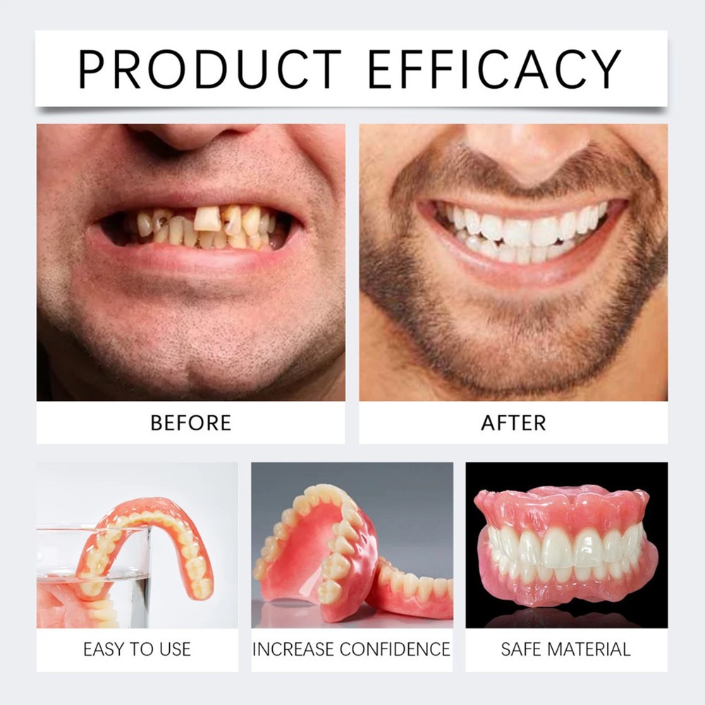 Easy Denture Top and Bottom Denture Solution Improve Smile Denture Full Set
