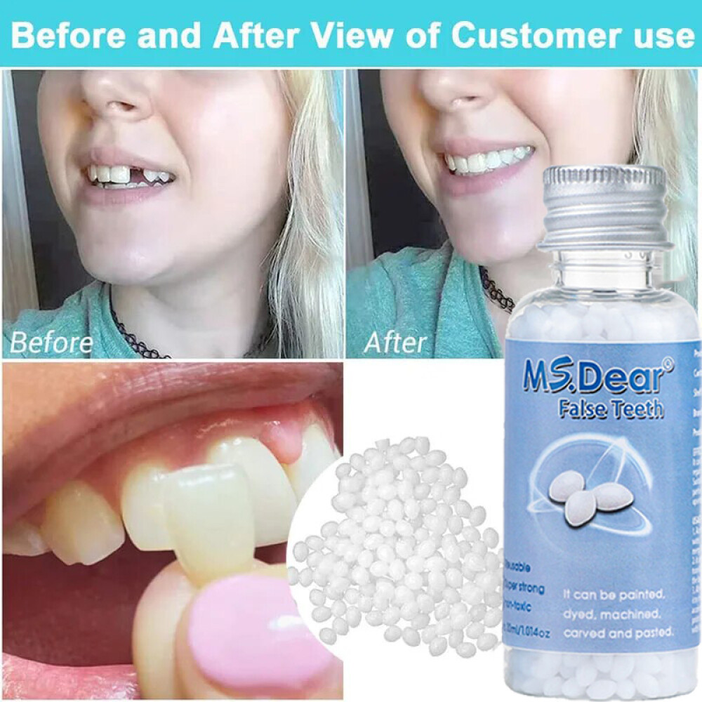 Tooth Repair Beads Granules Temporary Tooth Glue Reusable Moldable False Teeth