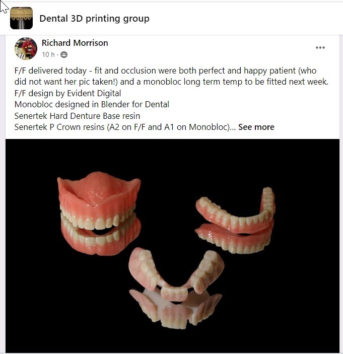DLP SLA LCD 3d printer denture base resin for manufacturing dentures