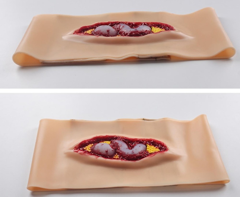 Abdominal Anatomical Wound Training Model