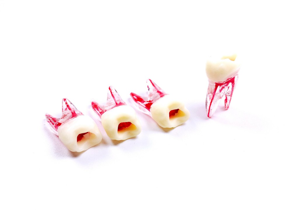 Dental Endo Root Canal File Training Study Model Student Practice Block Red Pulp