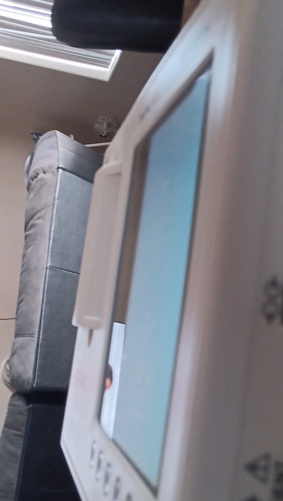 Digital Electrocardiograph ECG Machine with Printer & Lithium Battery