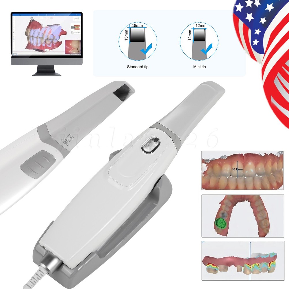 Digital Impression Intraoral Scanner Open Data Prosthetics Implants Orthodontics