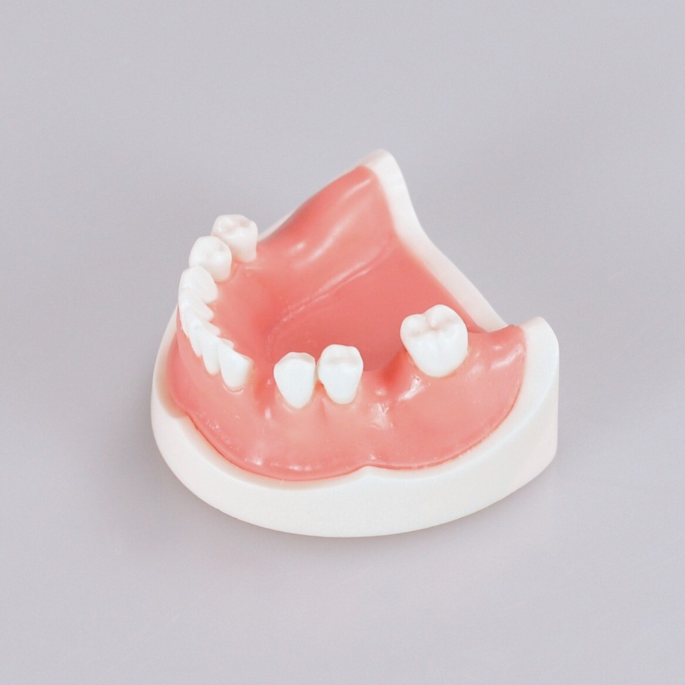Dental Teeth Missing Implanting Typodont Training Dentistry Model Display