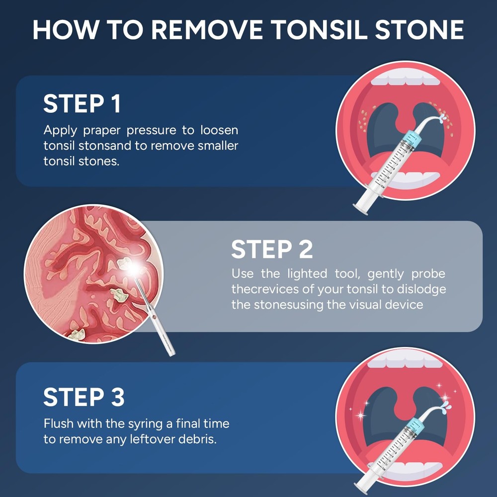 Tonsil Stone Remover with Camera - Upgraded Visual Tonsil Stone Removal Kit w...