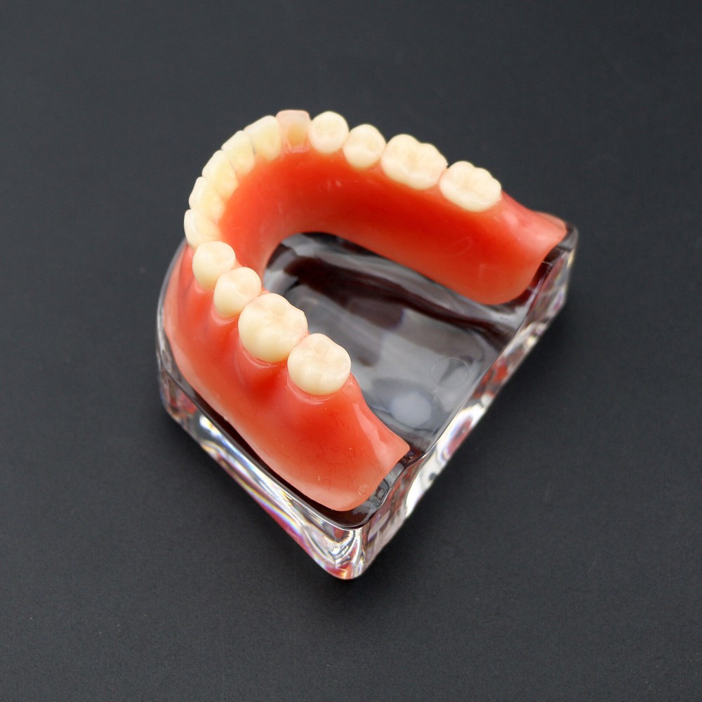 Dental Teeth Model Inferior Overdenture Precision 4 Implants Demo Silver Bar