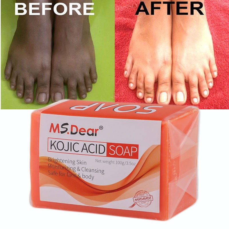 Kojic Acid Soap Dark Skin Whitening Bleaching Lightening Brightening Face & Body