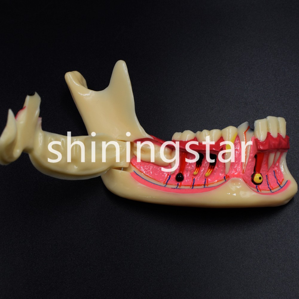 Dental Patient Teach Study Education Mandibular Tissue Teeth Anatomical Model