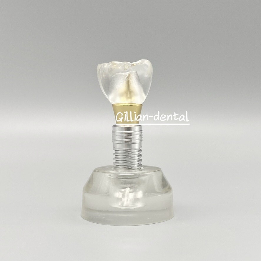 Dental Implant Model Detachable M2020 Demonstration Teeth Study Teach Models