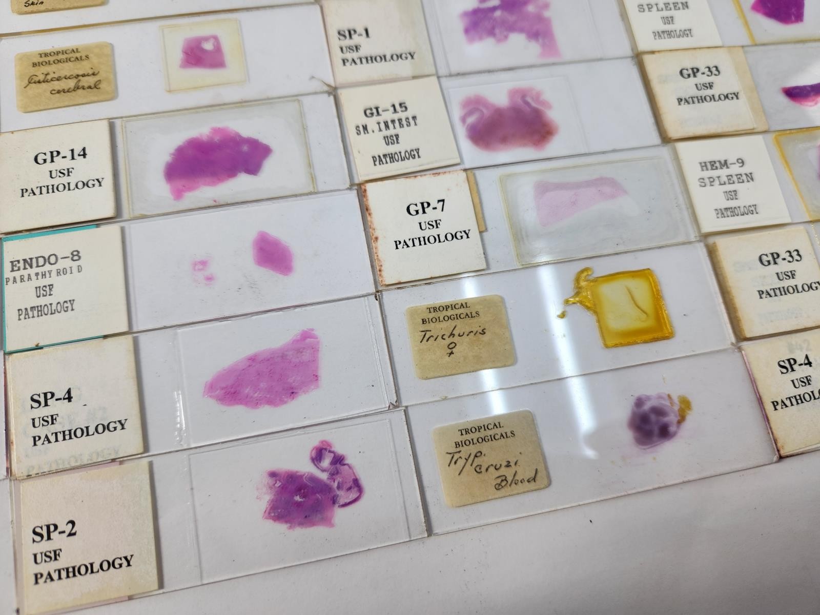 Lot Of 50 Vintage University Prepared Pathology Microscope Slides - Slides Only