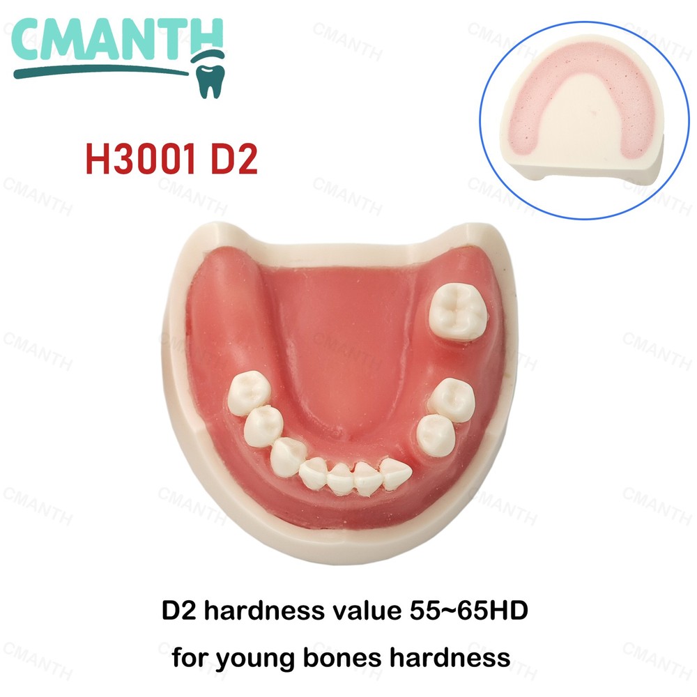 US Dental Removable Implant Teeth Model Drilling Training Soft Gums Model