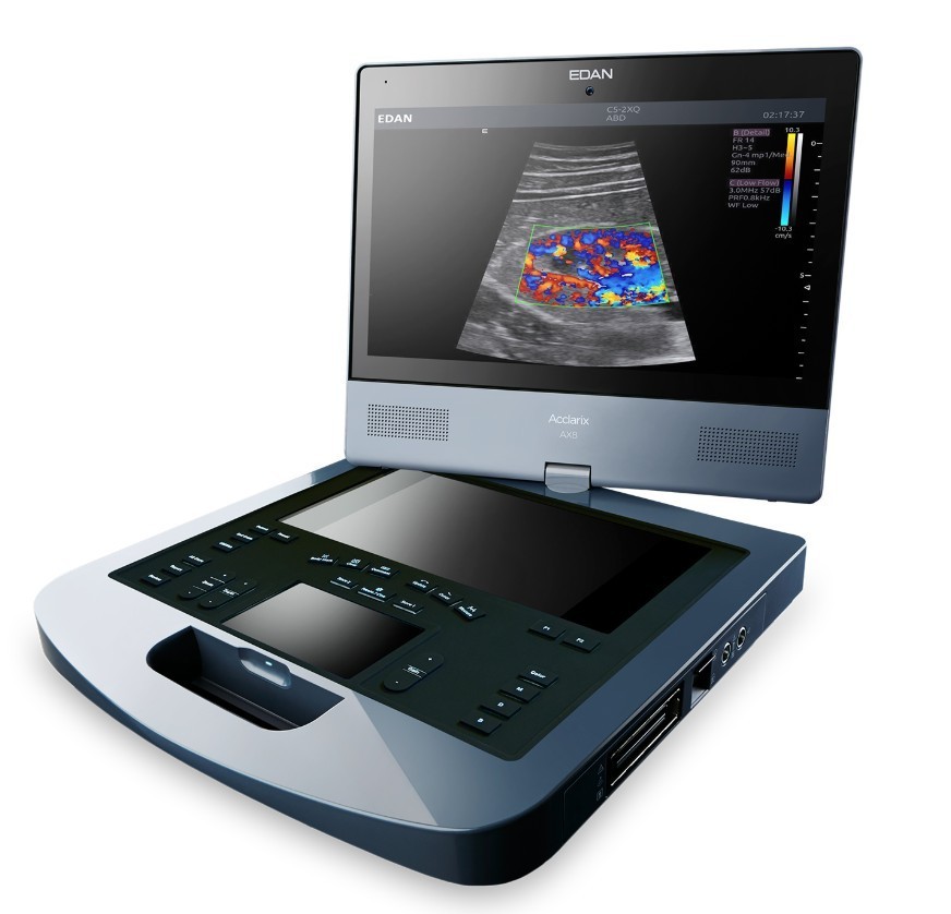 Ultrasound Machine New Edan AX8