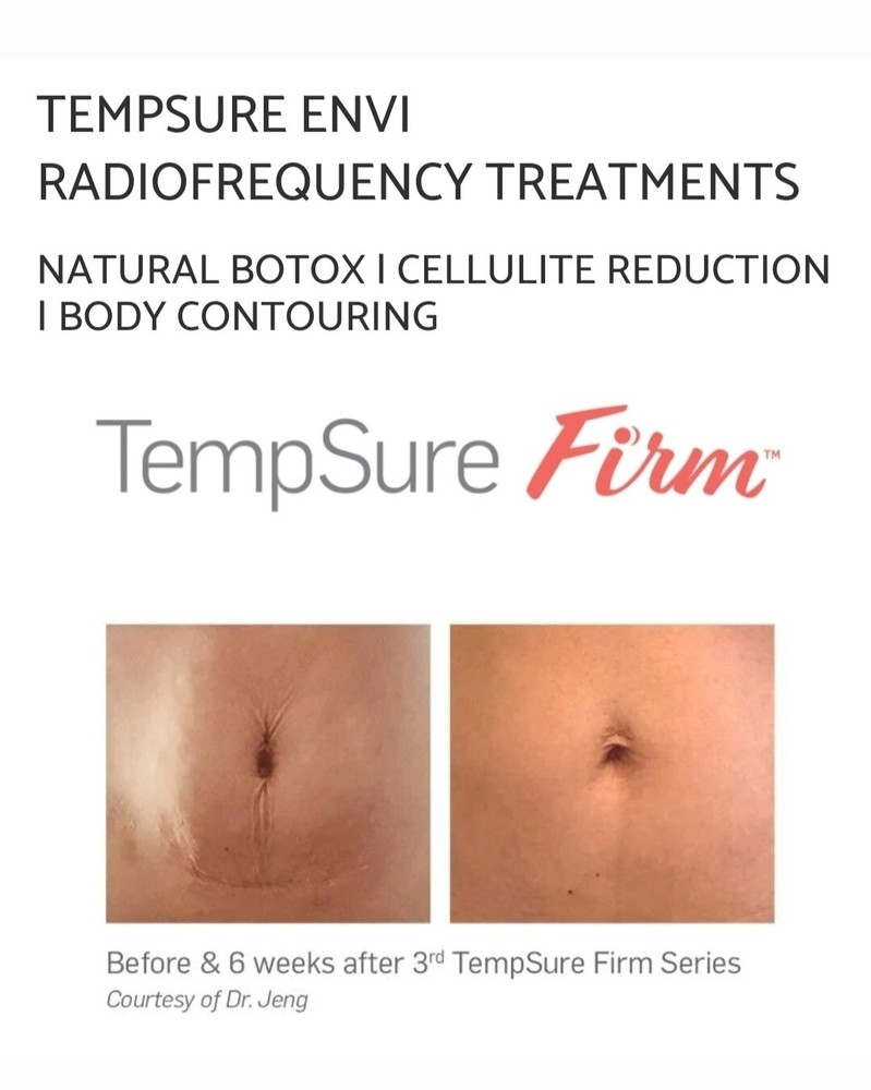 Tempsure Envi