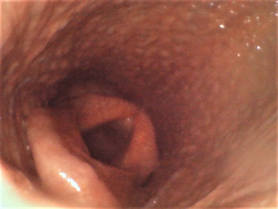 Vividia VE-8150 Portable Joystick Veterinary Horse Equine Upper Airway Endoscope