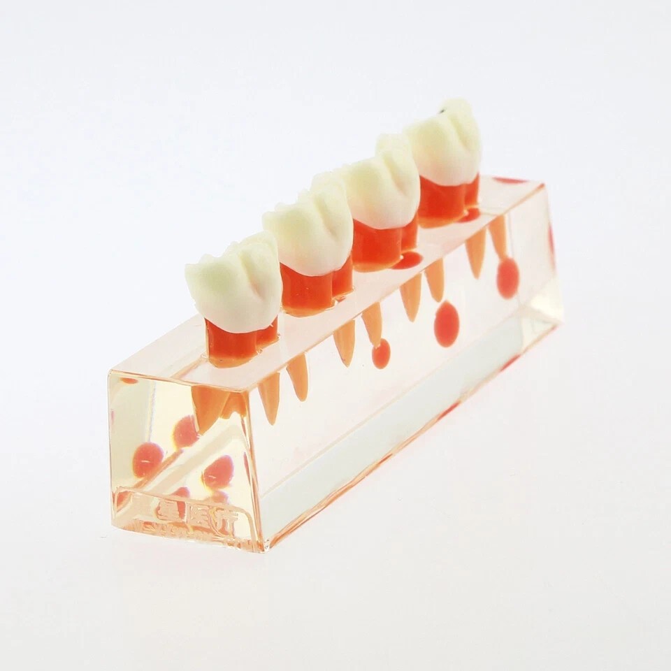 Dental Teeth Demonstrate Model #4018 Root Canal 4Stage Study Teaching Instrument