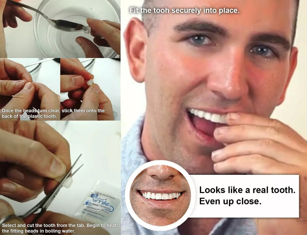 3 Pack Set Instant Smile Bright White Shade Temporary Teeth Replacement Kit
