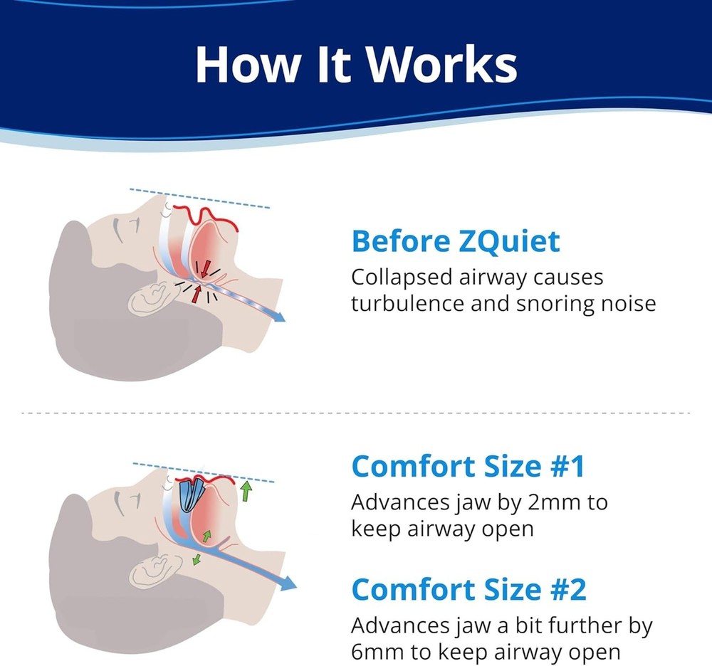Comfort Fit Snore Stopper Pack