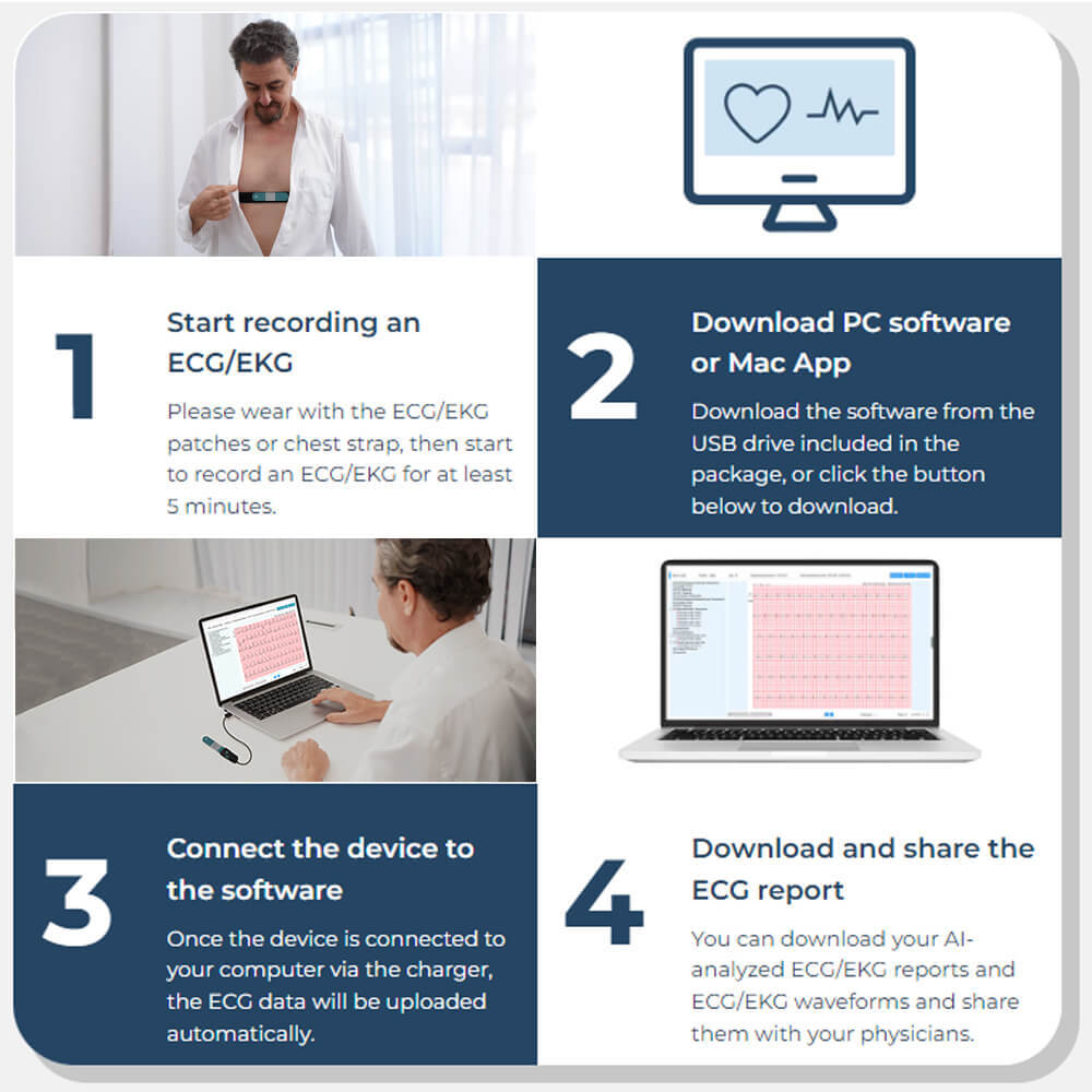 Holter Monitor 24 hours EKG Monitor ECG Recording PC Software Free AI Analysis