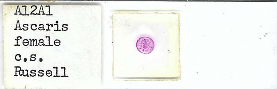 Ascaris Female  c.s. Microscope Slide