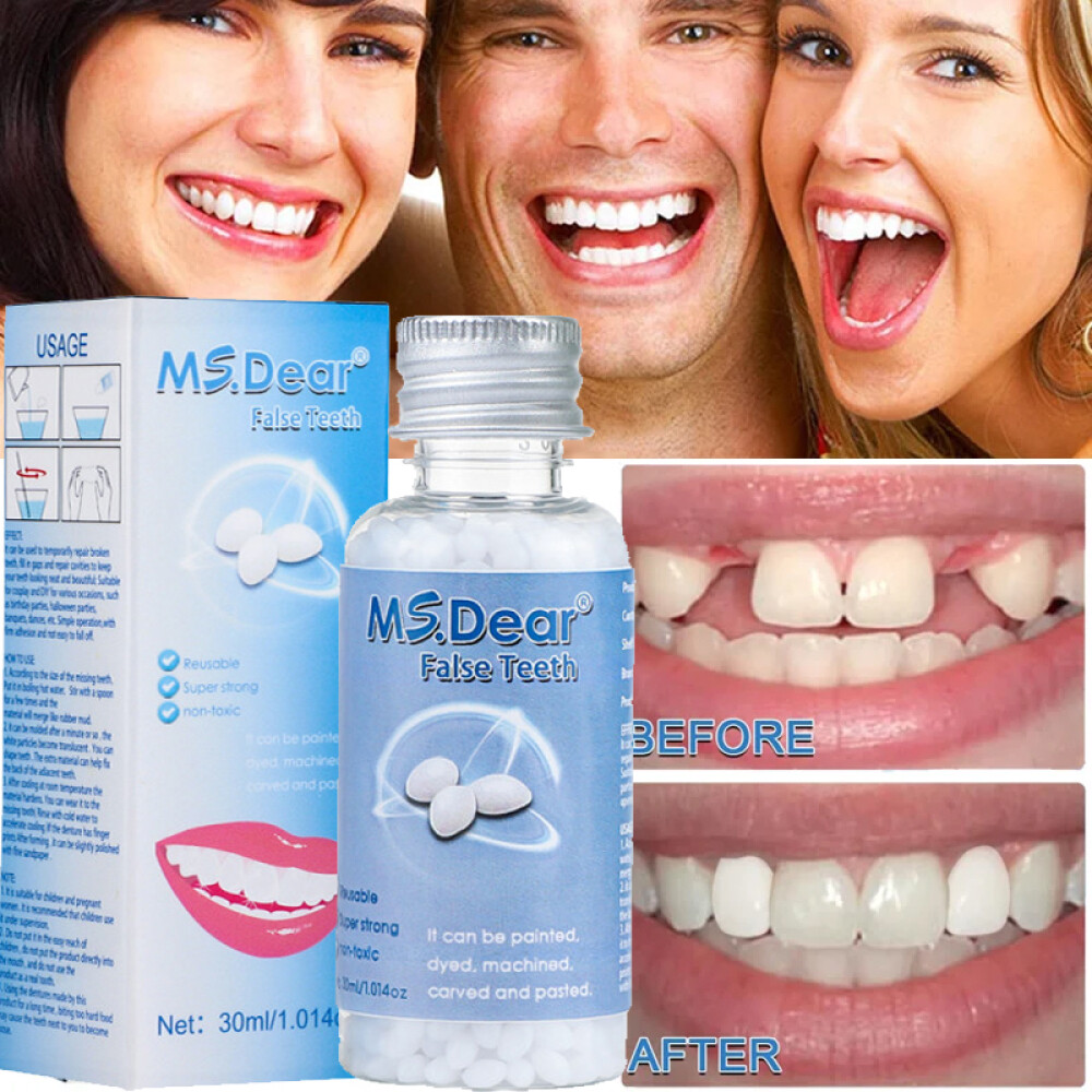 3X Tooth Repair Kit - Temporary Teeth Replacement Kit for Missing & Broken Teeth