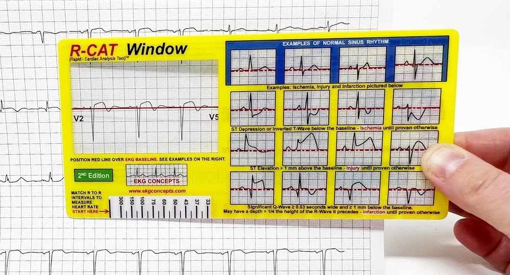 EKG Window 2nd Edition