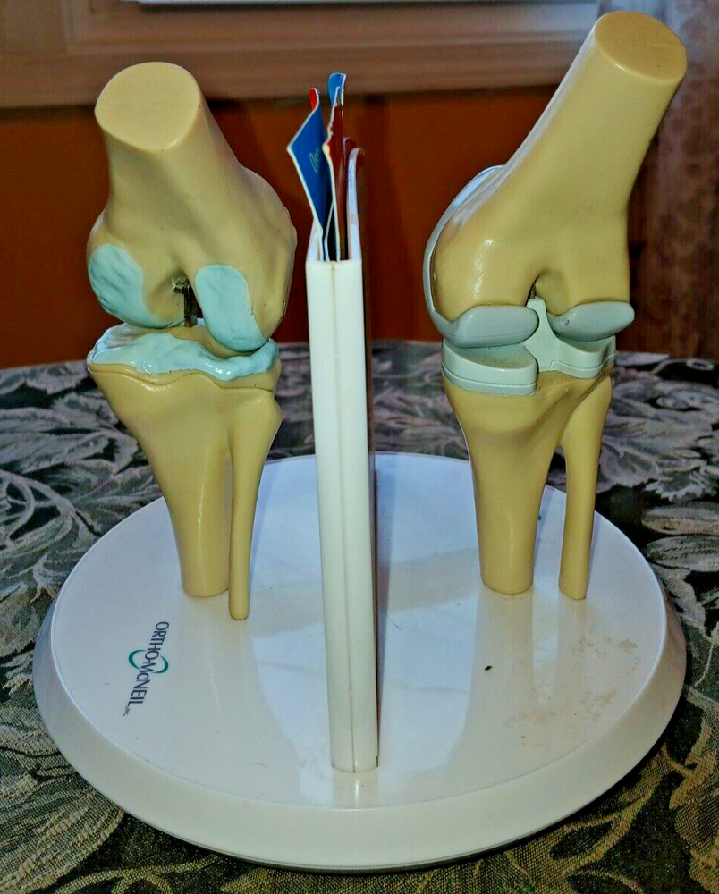 Anatstat ARTIFICIAL KNEE REPLACEMENT Medical Anatomical Skeleton DEMO MODEL