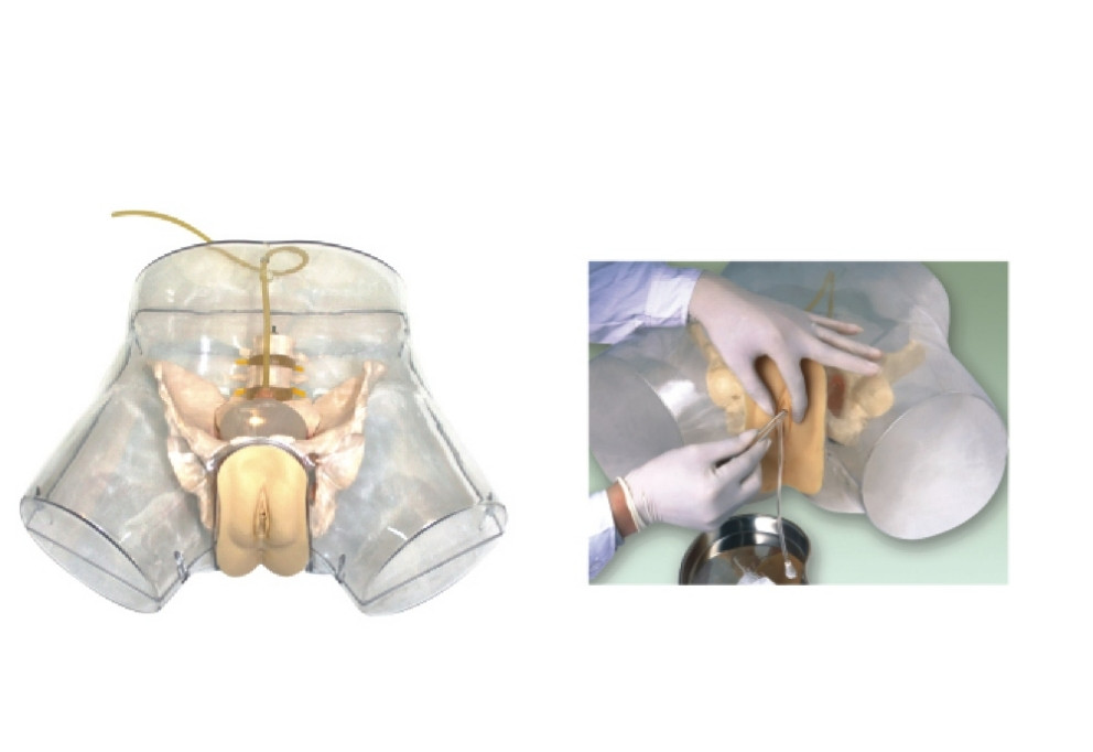 1:1 Human Female Transparent Catheterization Model Training Display Model