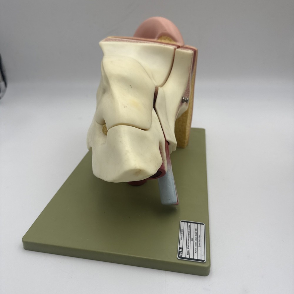 Somso DS5 Ear Anatomical Model - Hearing Inner Ear