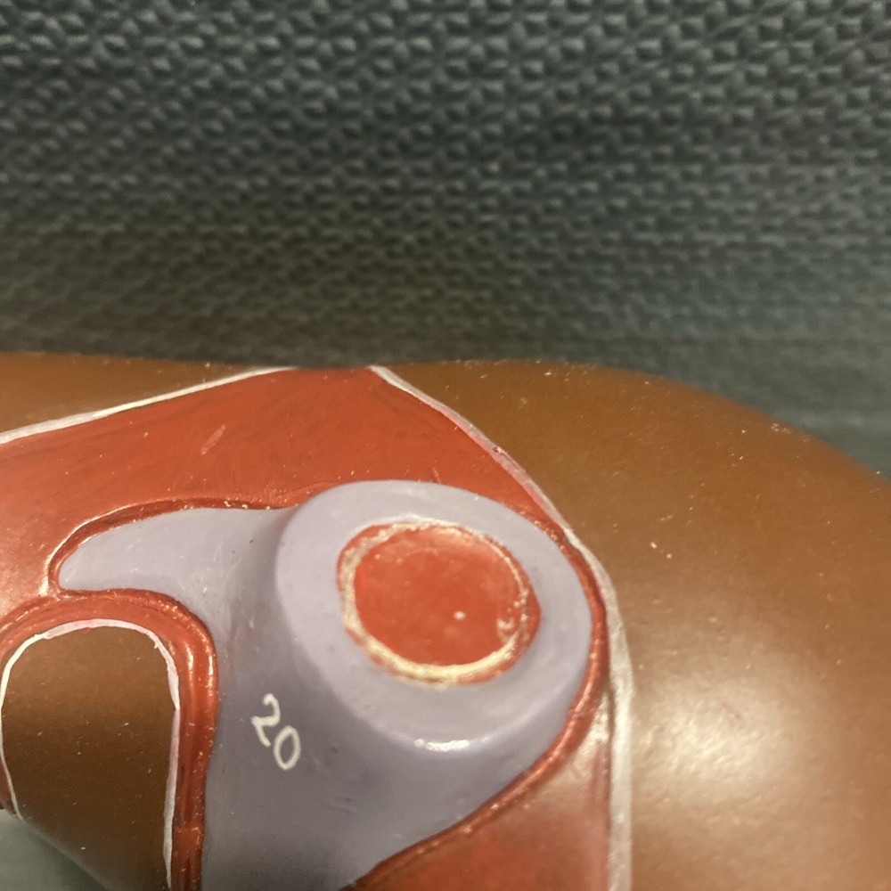 Somso Liver On Adjustable Stand Model - Numbered - Damaged