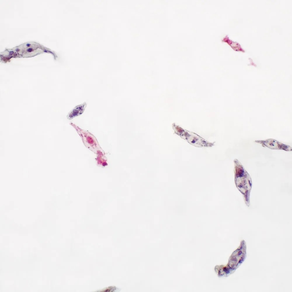 ABGIL Minor Phylla Slides.