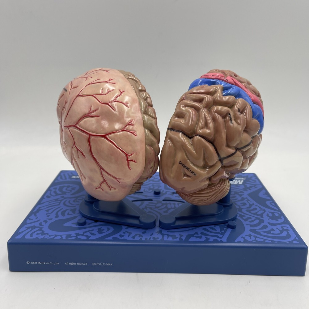 Maxalt Brain Anatomical Model Migraine Pathology Education Teaching Model