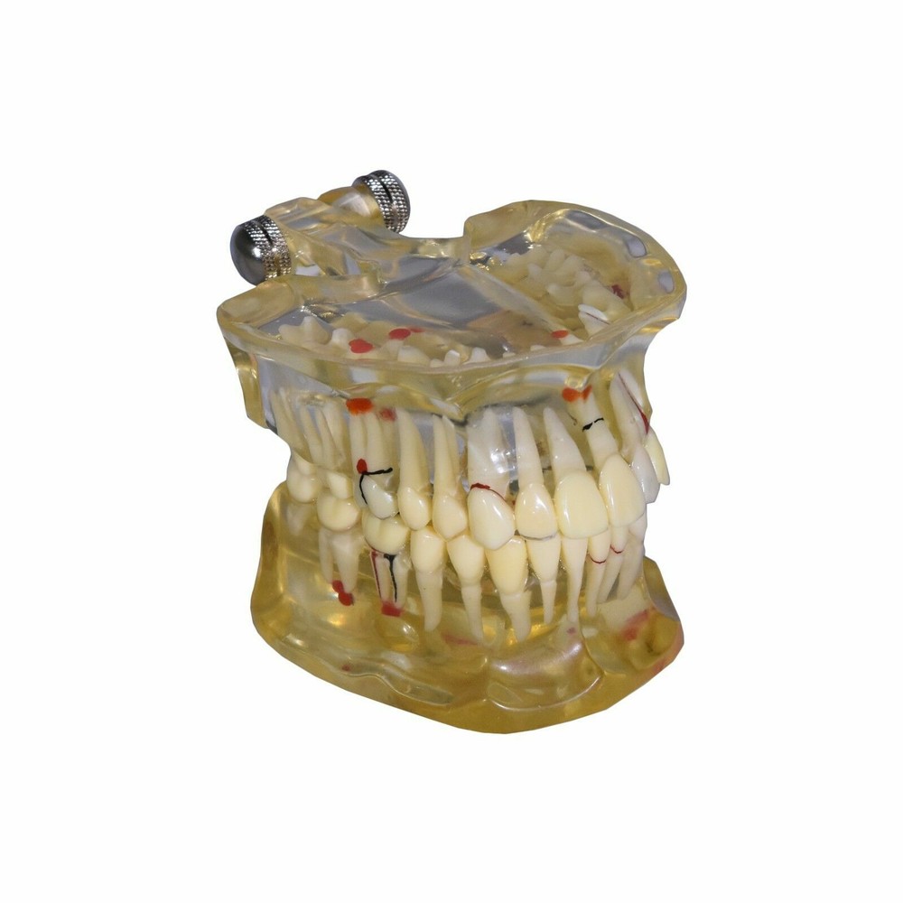 REDLAND 1331 Model Dental Demonstration Teeth Educational Model