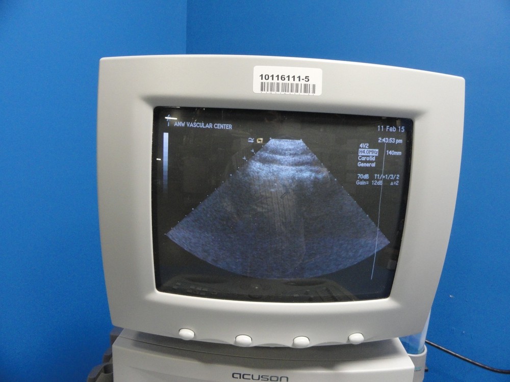 Siemens Acuson 4V2 Vector Array Ultrasound Probe – For Sequoia Series ~ 8588