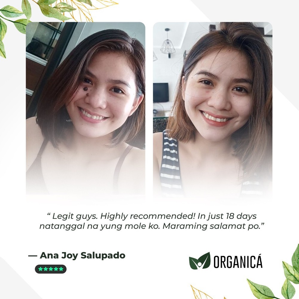 Multi-Awarded Mole and Warts Remover Set