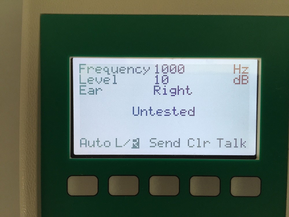 Micro Audiometers Earscan 3 Screening Audiometer (ES3S)