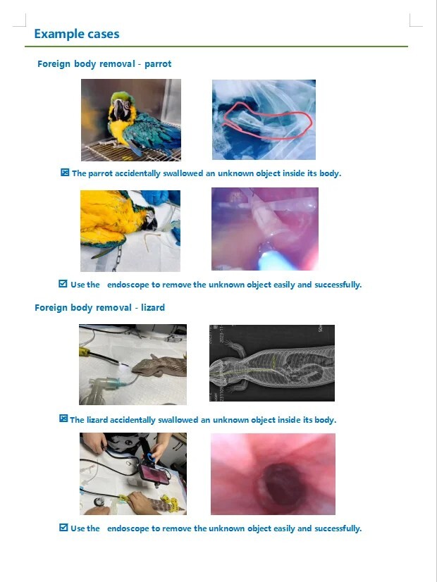 Gastrointestinal Bronchus Endoscopy With 360° Steering，Inclusive Biopsy Forceps