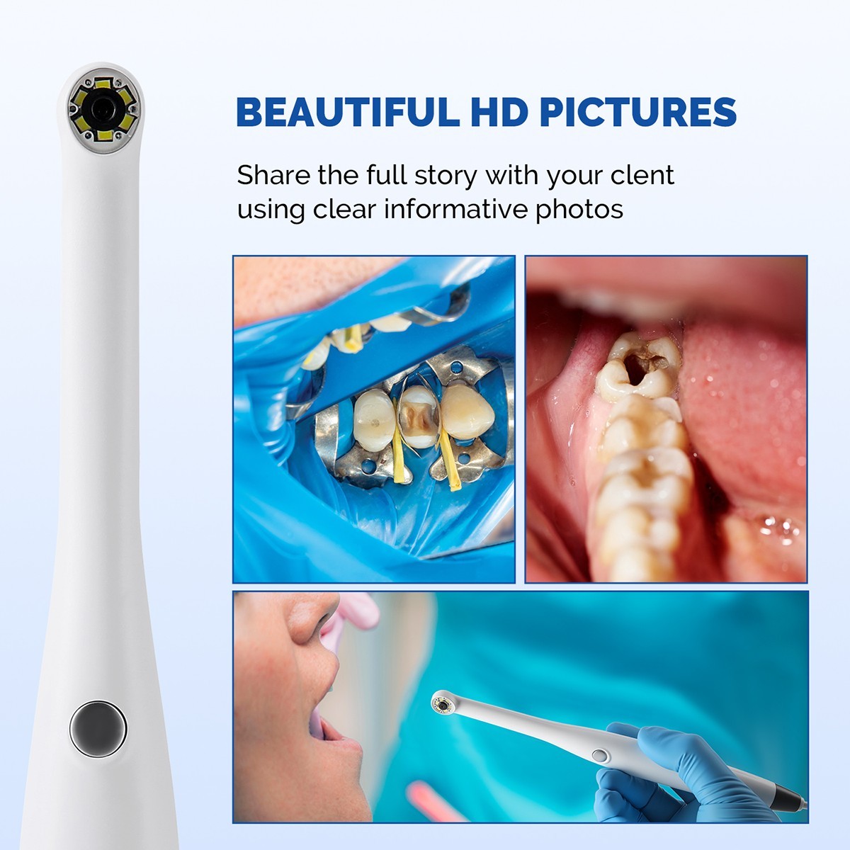 Dental USB HD 720P Intraoral Camera Imaging Intra Oral Endoscope 6 LEDS