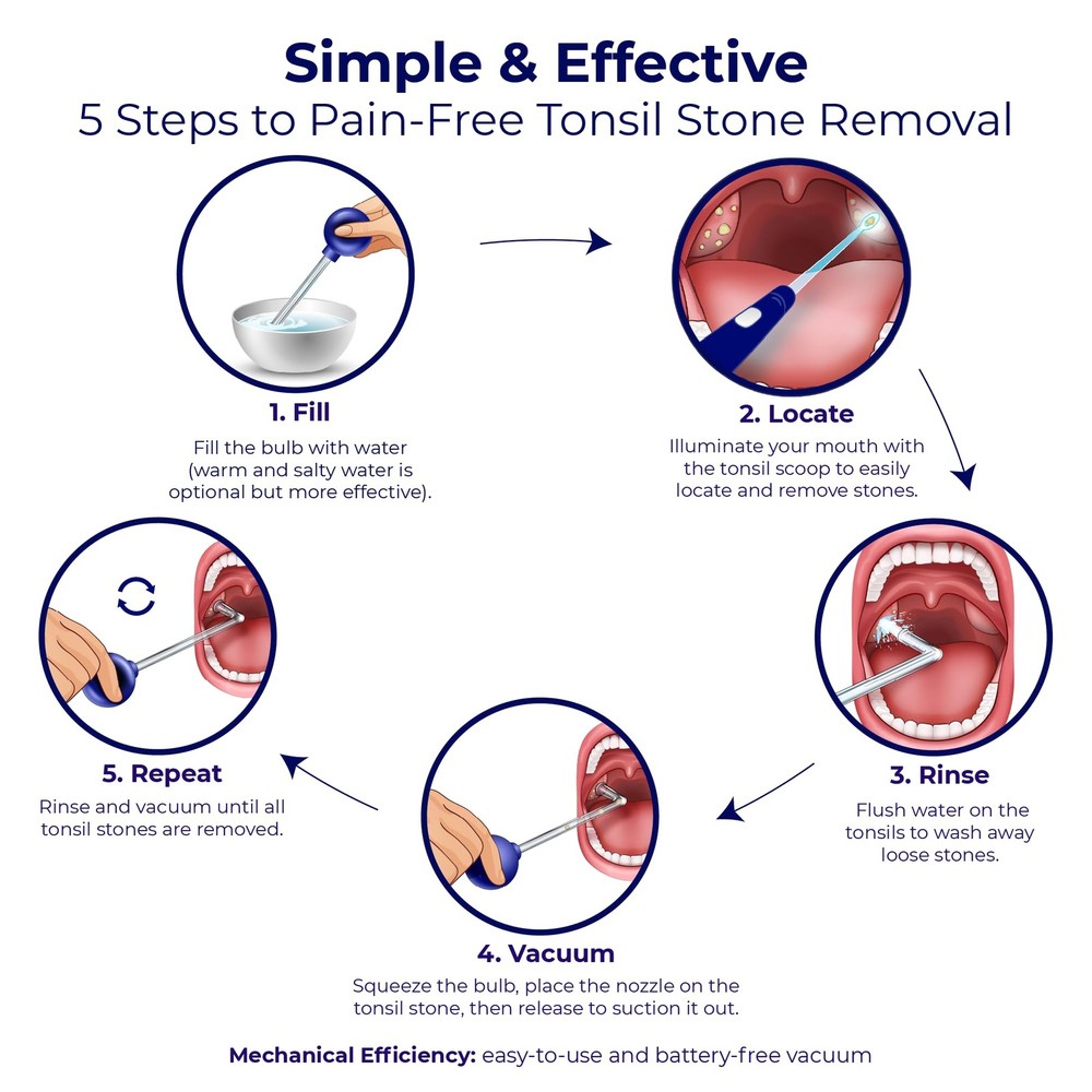 Oravix Tonsil Stone Vacuum, Remover Vacuum Suction, Tonsil...