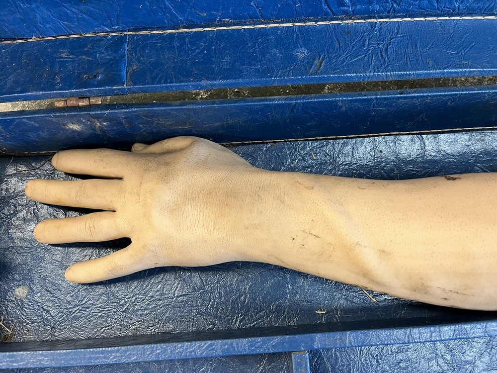 Nasco Life/Form Phlebotomy IV Injectable Training Arm With Case