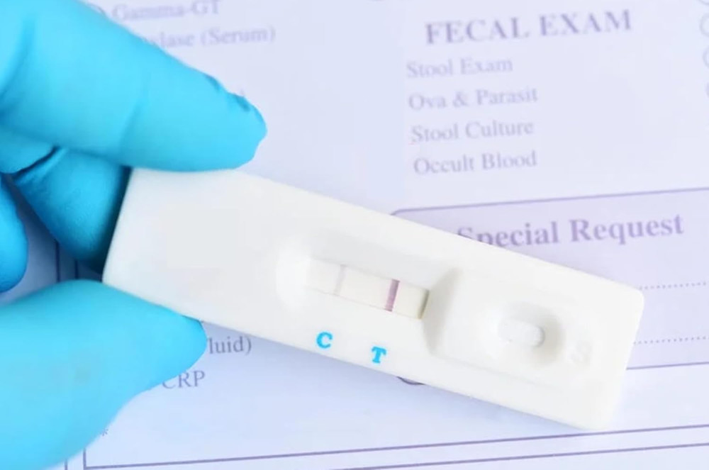 Fecal Occult Blood in Stool Test (2 Tests)