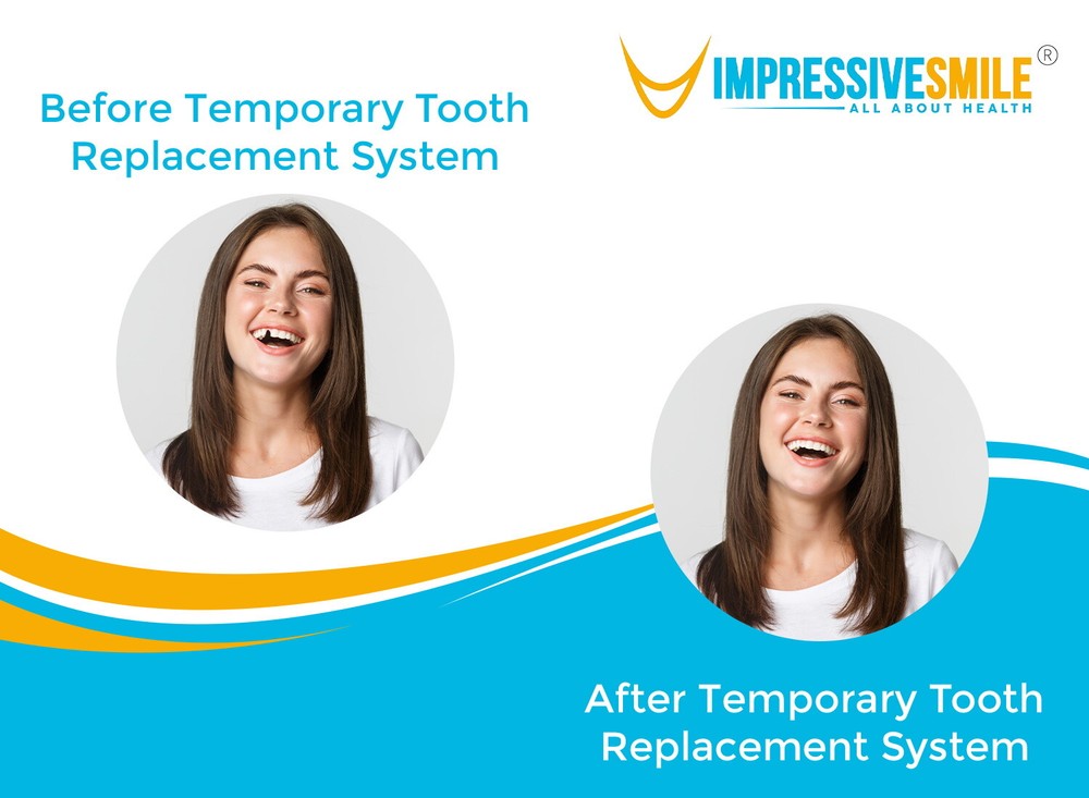 Patient Trusted Temporary Tooth Replacement System