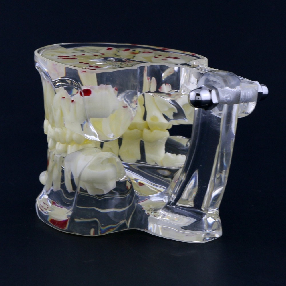 Dental Children Pediatric Pathology Demonstration Study Tooth Teeth Model 4002