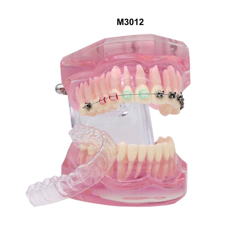 Dental Typodont Model Self-ligating Metal Bracket Ceramic Transparent Retainer