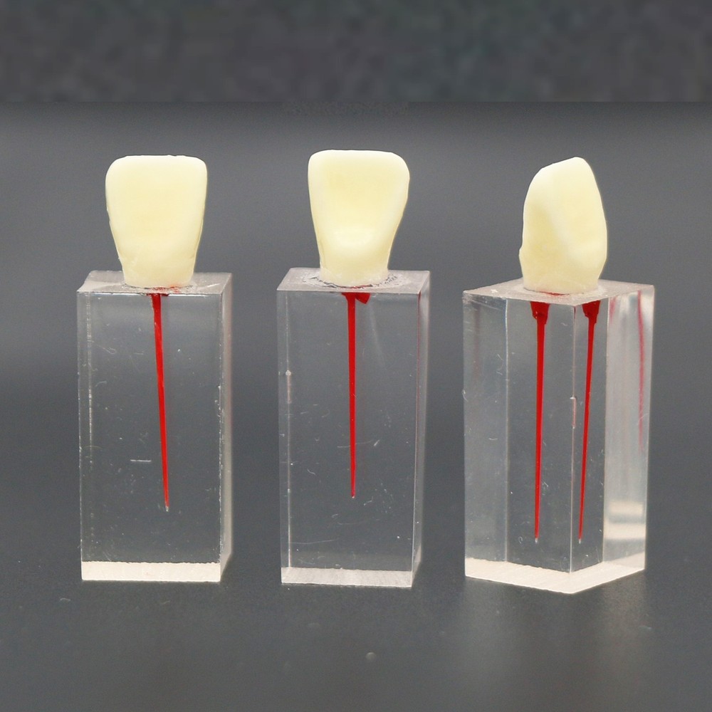 5Pcs Dental Root Canal Teeth molar Model Study Practice For Endodontic Pulp File