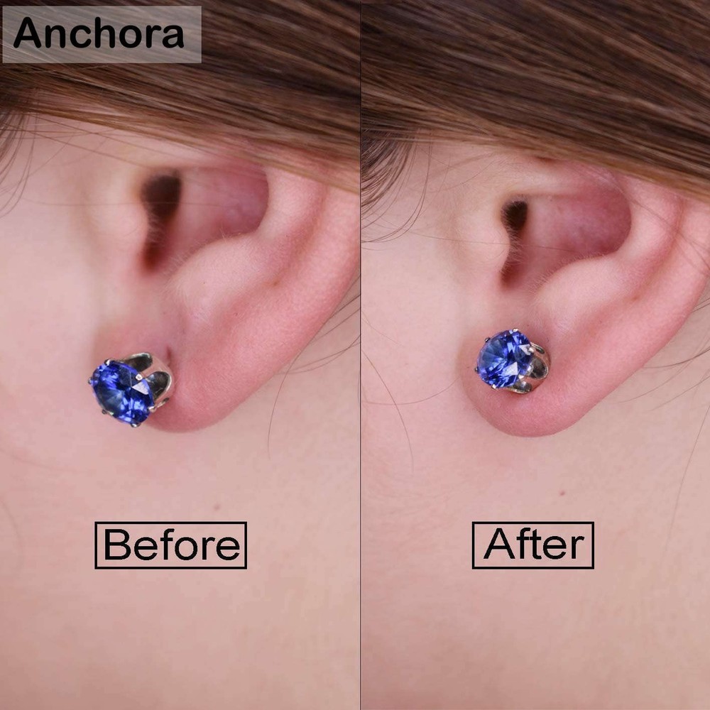 Magic Earring Backs for Droopy Ears | Earring Lifters | Secure Earlobe Backs