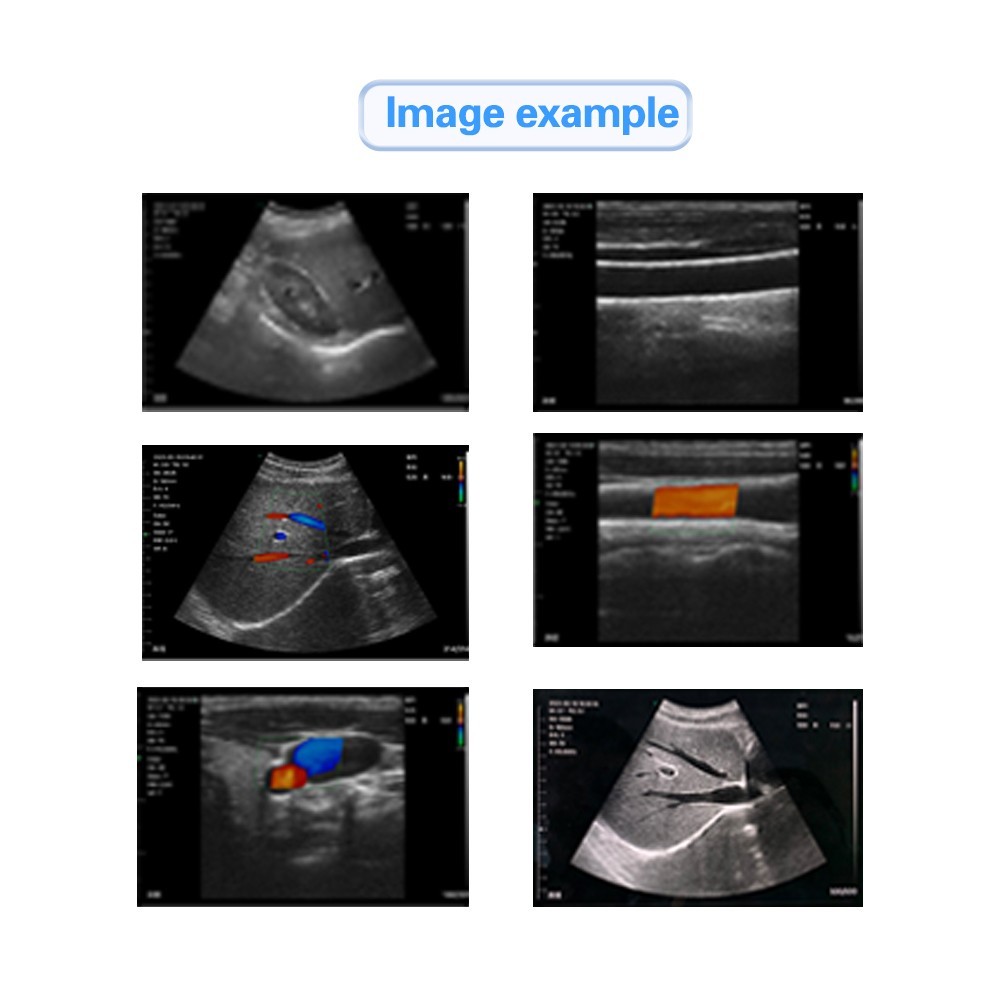 Portable Wireless Ultrasound linear Scanner Probe 80 element