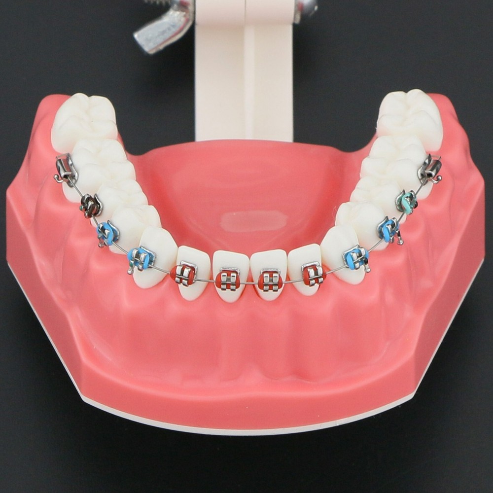 US Dental Typodont Teeth Model with Orthodontic Brackets Brushing