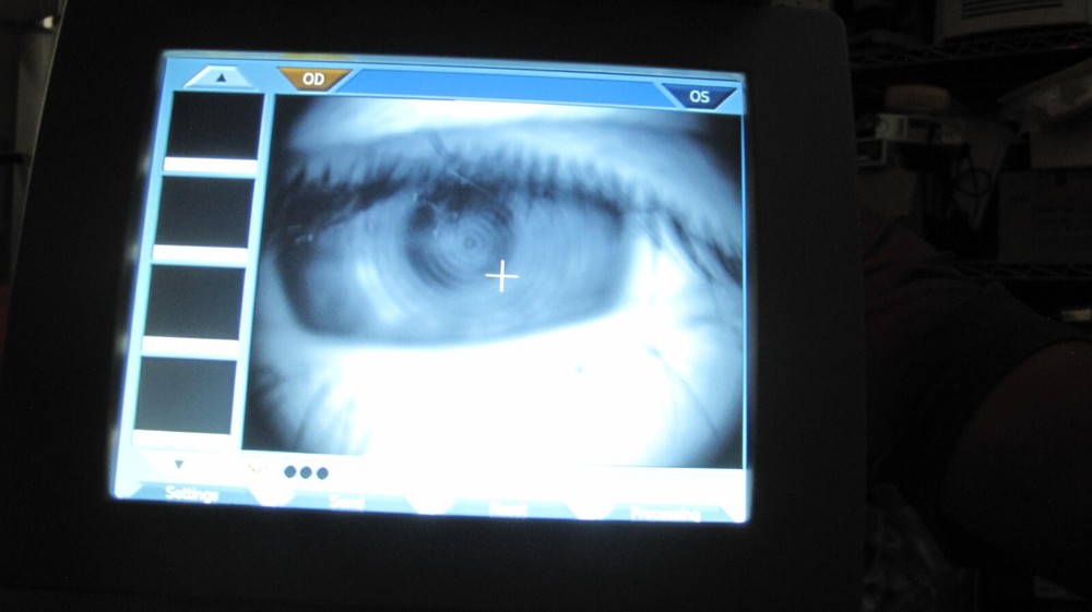 TOPCON CA-200 CORNEAL ANALYZER TOPOGRAPHER (UNTESTED) READ DESCRIPTION