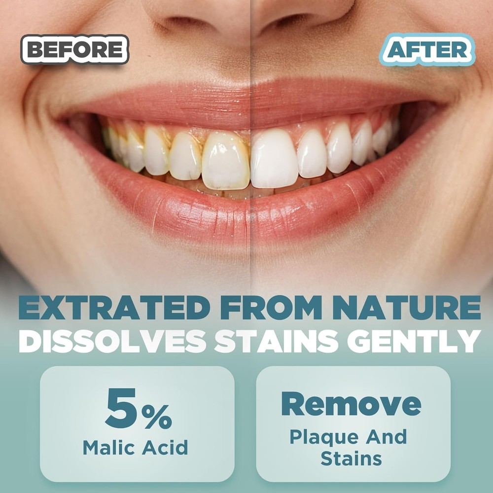 Fluoride-Free Probiotic Toothpaste Tabs: Travel, Fresh Breath, Sensitive Teeth