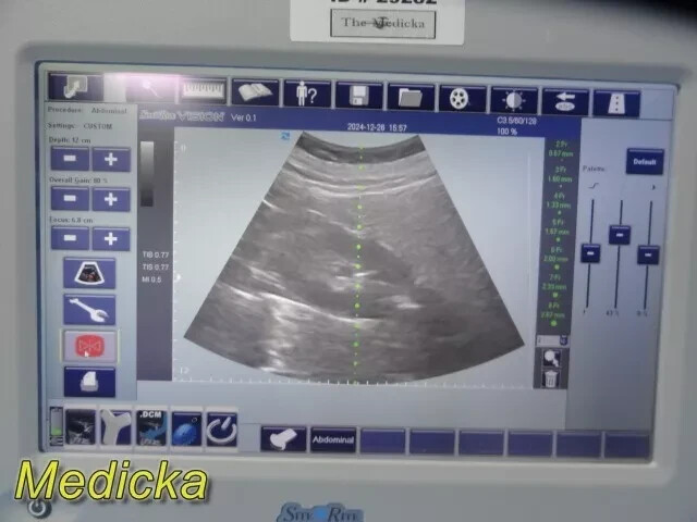 36099 |B@RD-Type SiteR¡te Vision Convex Probe | Ref 9770035 | Used, Tested